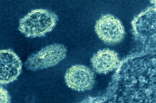 Virus cúm mới có ‘tiềm năng trở thành đại dịch’ được tìm thấy ở Trung Quốc