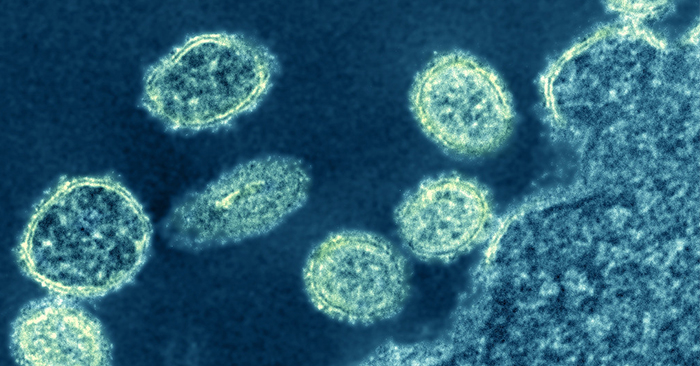 Virus cúm mới có 'tiềm năng trở thành đại dịch' được tìm thấy ở Trung Quốc