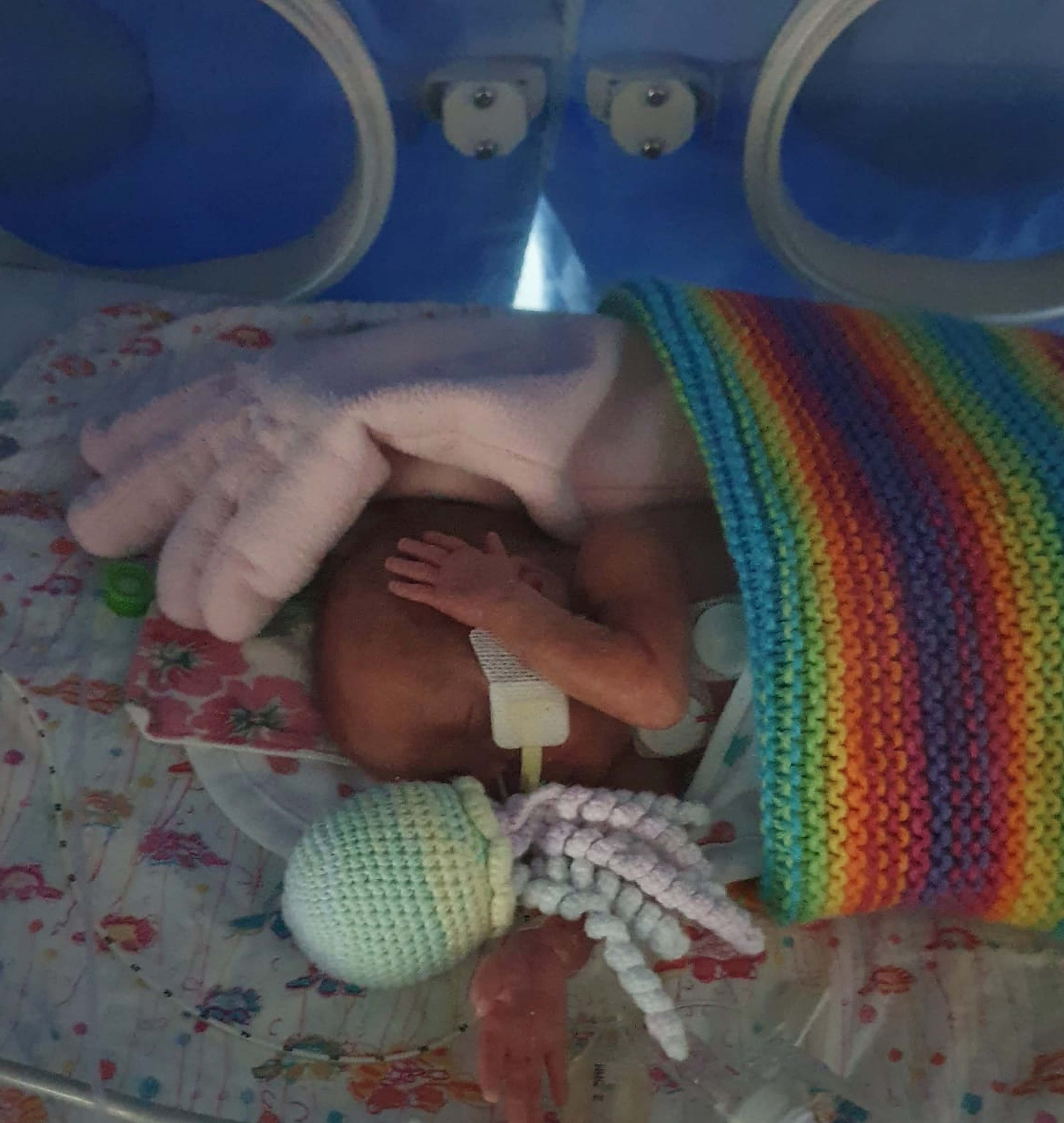 Bé Millie, sinh ra sau 23 tuần và 6 ngày, chỉ nặng chưa đến một bao gạo. (Ảnh Caters News)