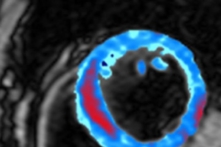 Chính quyền Trump đầu tư 1 tỷ USD vào Máy tính lượng tử và AI