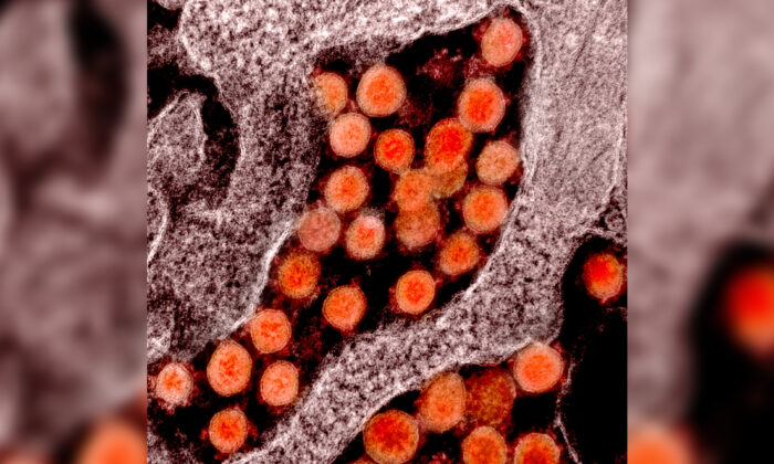 Hình ảnh hiển vi điện tử của virus Vũ Hán, hay còn gọi là virus SARS-CoV-2, được phân lập từ bệnh nhân. (Ảnh NIAID)