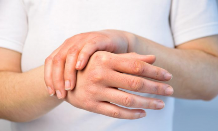 Bàn tay khô có thể là dấu hiệu tuần hoàn máu kém