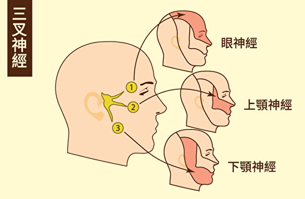 mẹo chữa Đau dây thần kinh V