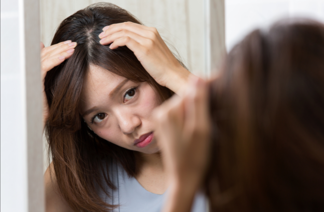 Nguyên nhân rụng tóc là gì? 3 phương thức của Trung y giúp mọc tóc