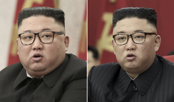 Băng dán đầu của ông Kim Jong Un