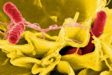 CDC: Sự bùng phát vi khuẩn Salmonella không rõ nguồn gốc lan rộng đến 29 tiểu bang