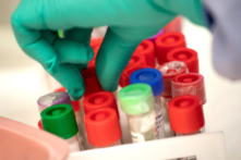 Nghiên cứu: Kháng thể tồn tại hơn một năm sau khi nhiễm COVID-19