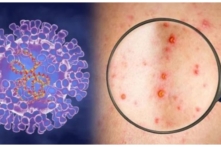 Tin Việt Nam ngày 27/5: Sài Gòn giám sát bệnh đậu mùa khỉ tại các cửa khẩu, Lạng Sơn tiếp tục ùn ứ hơn 1,000 xe nông sản