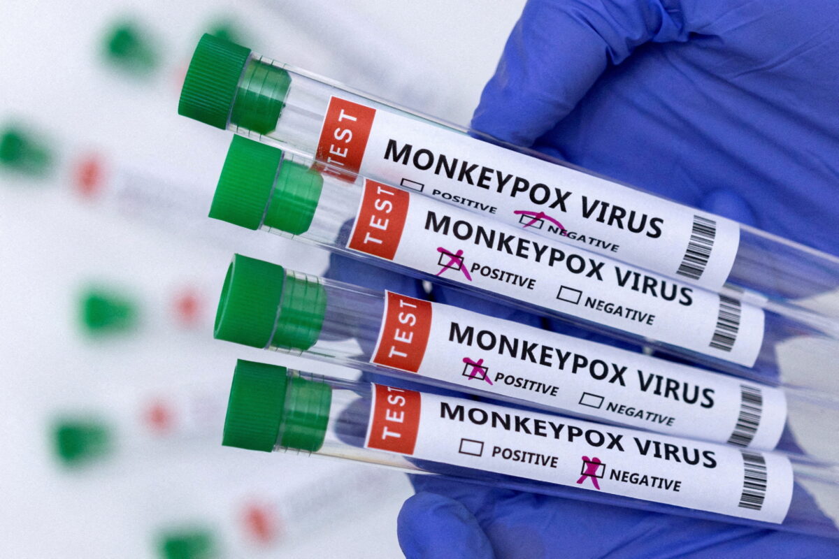 Nghiên cứu mới tiết lộ manh mối về sự lây lan nhanh chóng của virus đậu mùa khỉ