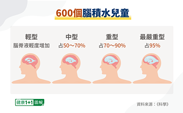 Không có não nhưng chỉ số IQ 126! Bí mật của những người ‘không não’