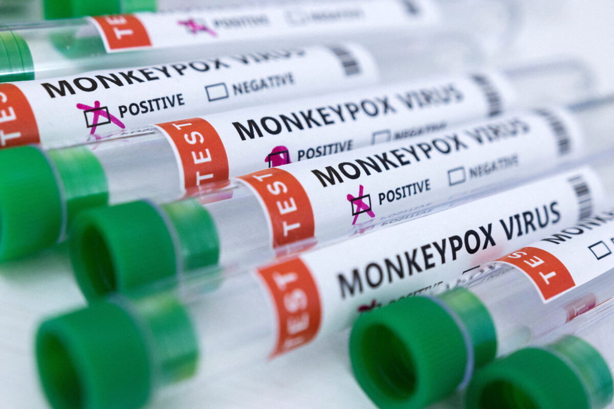 Thống đốc các tiểu bang Illinois và California tuyên bố tình trạng khẩn cấp do bệnh đậu mùa khỉ