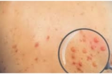 Tin Việt Nam ngày 23/08: Giám sát bệnh đậu mùa khỉ bằng cách đo thân nhiệt tại cửa khẩu; xác định 4 đường dây mua bán người sang Campuchia