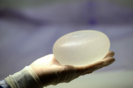 Cảnh báo an toàn của FDA: Phát hiện ung thư trong mô sẹo xung quanh túi ngực