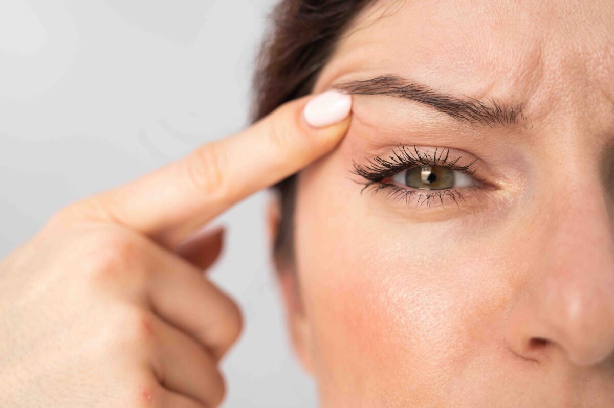Kiểm soát chứng viêm mi mắt một cách hiệu quả