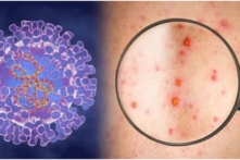 Tin Việt Nam sáng 03/10: Ghi nhận ca đậu mùa khỉ đầu tiên tại Sài Gòn; Nghệ An tan hoang sau cơn lũ ống lịch sử 20 năm