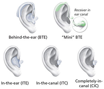 Mất thính lực do tuổi tác