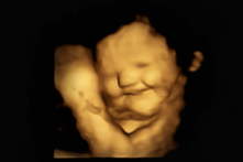 Em bé mỉm cười khi mẹ ăn cà rốt nhưng lại khóc vì hương vị của rau cải xoăn