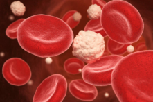 Vận động giúp tăng cường tuần hoàn máu(Tatiana Shepeleva/Shutterstock)