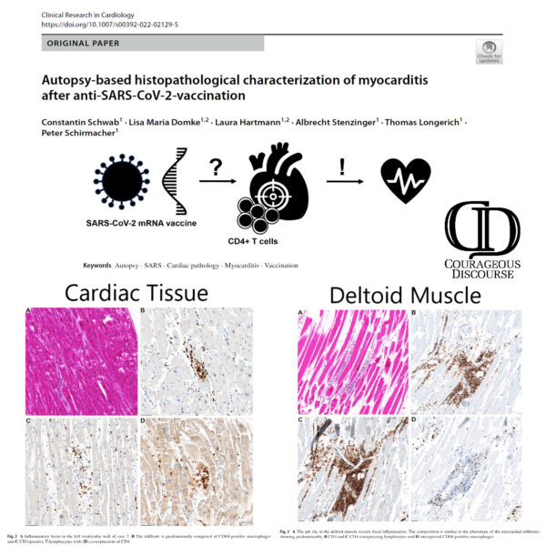 Ông Schwab, C., Domke, L.M., Hartmann, L. và cộng sự. Đặc điểm mô bệnh học dựa trên khám nghiệm tử thi của viêm cơ tim sau khi chích vaccine phòng SARS-CoV-2. Clin Res Cardiol (2022). https://doi.org/10.1007/s00392-022-02129-5
