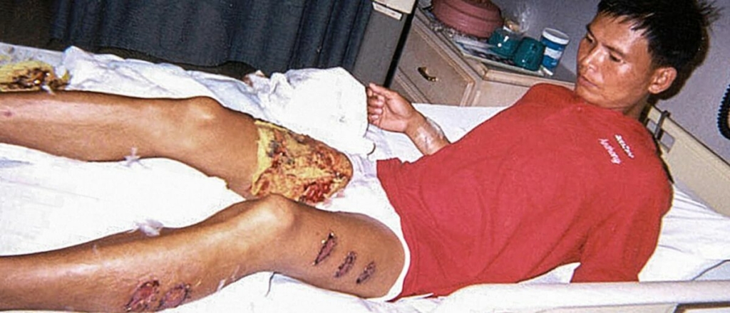 Học viên Pháp Luân Công Đàm Vĩnh Khiết (Tang Yongjie) bị cai ngục tra tấn bằng cách dùng dây sắt nung đỏ trói quanh chân trong một trại lao động ở khu Bác La, tỉnh Quảng Đông, Trung Quốc, vào năm 2001. (Ảnh: Minghui.org)