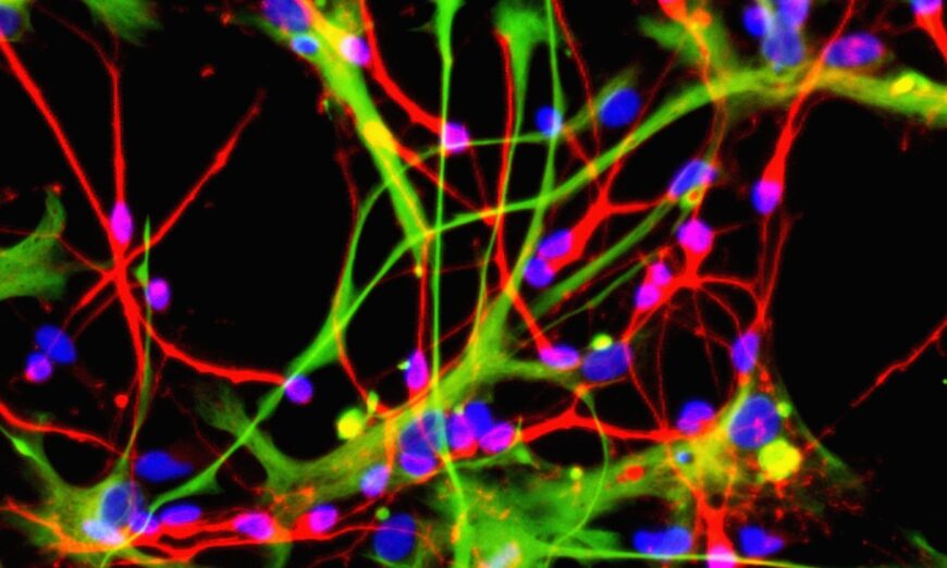 Nghiên cứu: Kỹ thuật công nghệ nano giúp khôi phục tế bào thần kinh bị thương tổn