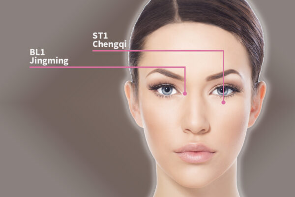 Huyệt Tỉnh Minh (Jingming): nằm ở chỗ lõm khóe trong của mắt. Huyệt Thừa Khấp (Chengqi): nằm ngay bên dưới con ngươi ở ổ mắt dưới. (Shutterstock/The Epoch Times)