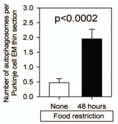 Hình 4 Những con chuột bị hạn chế thực phẩm sau 48 giờ cho thấy số lượng autophagosome tăng gấp ∼ 4 lần.