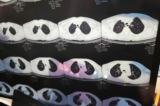 Một bác sĩ xem ảnh chụp CT của một bệnh nhân ở Hải Điến, Bắc Kinh, Trung Quốc, hôm 02/01/2023. (Ảnh: CFOTO/Future Publishing qua Getty Images)