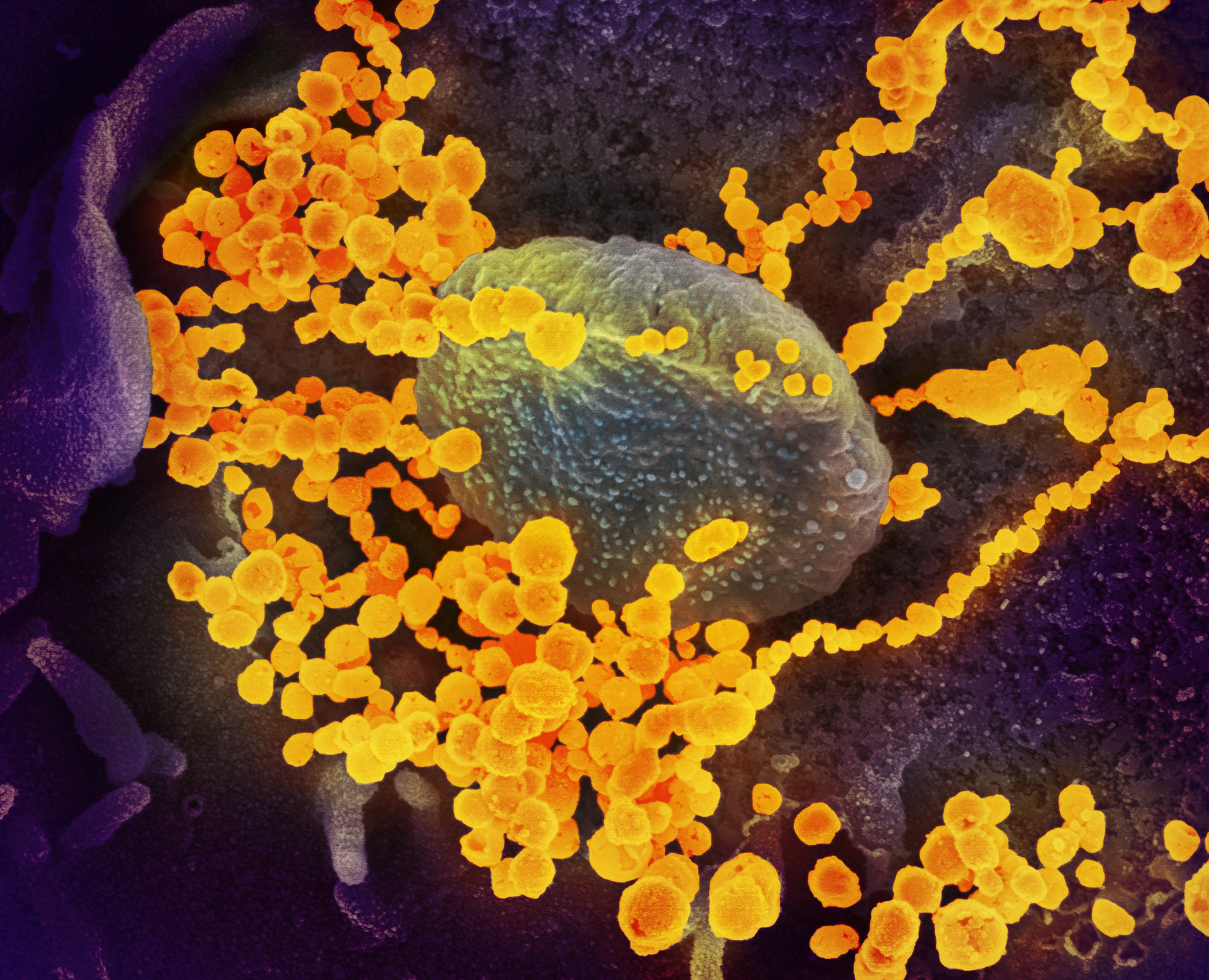 Hình ảnh kính hiển vi điện tử cho thấy SARS-CoV-2 (vật thể tròn bằng vàng), gây ra COVID-19, xuất hiện từ các tế bào nuôi cấy. (NIAID)