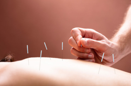 Nghiên cứu: Châm cứu giúp trị chứng mất ngủ an toàn và hiệu quả