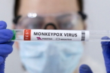 Các ống nghiệm có dán nhãn "Dương tính với virus đậu mùa khỉ" trong ảnh minh họa này được chụp vào ngày 23/05/2022. (Ảnh: Dado Ruvic/Illustration/Reuters)
