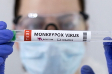 Các ống nghiệm có dán nhãn "Dương tính với virus đậu mùa khỉ" trong ảnh minh họa này được chụp vào ngày 23/05/2022. (Ảnh: Dado Ruvic/Illustration/Reuters)