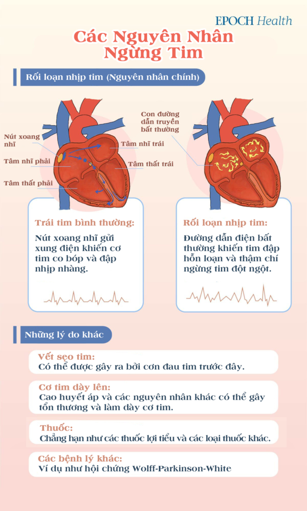 ĐỒ HỌA THÔNG TIN: Hướng dẫn đầy đủ về ngừng tim: Nguyên nhân chính và 2 bước sơ cứu để ngăn ngừa tử vong