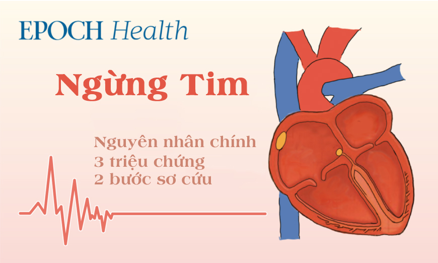 Hướng dẫn đầy đủ về ngừng tim: Nguyên nhân chính và 2 bước sơ cứu để ngăn ngừa tử vong