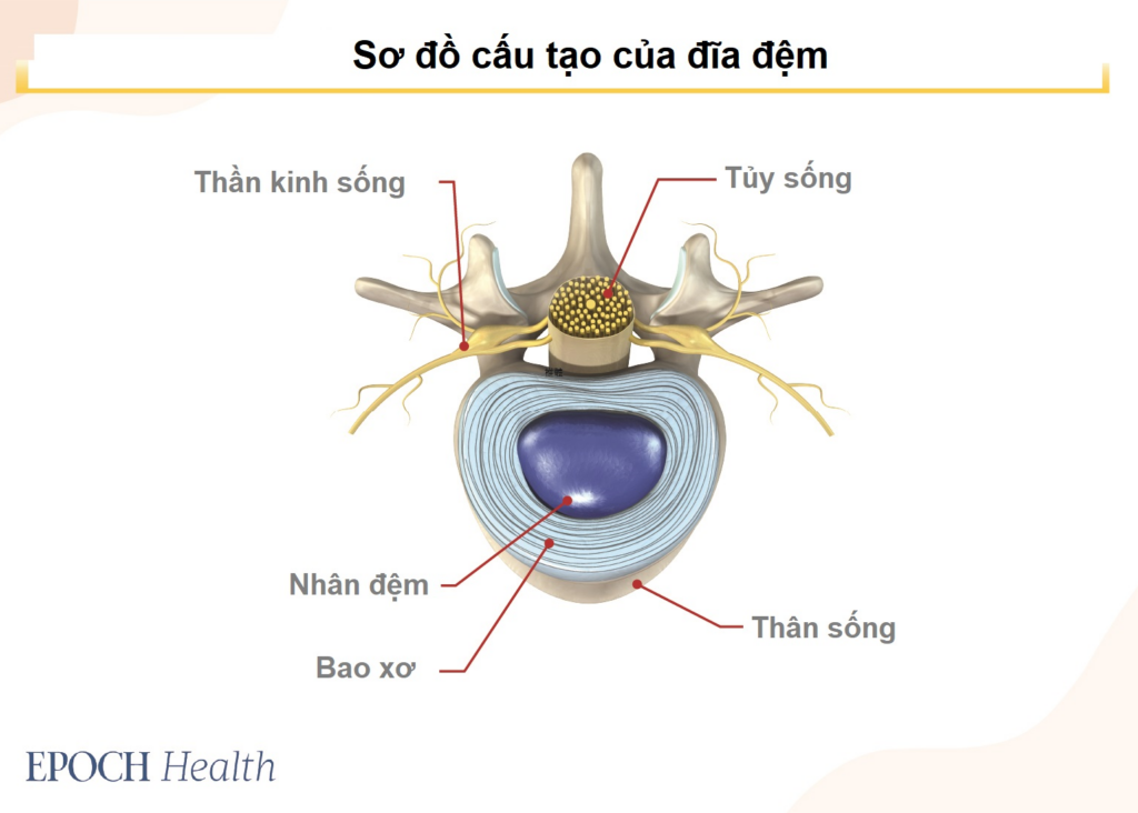 Đau thắt lưng: Nguyên nhân, điều trị và dự phòng