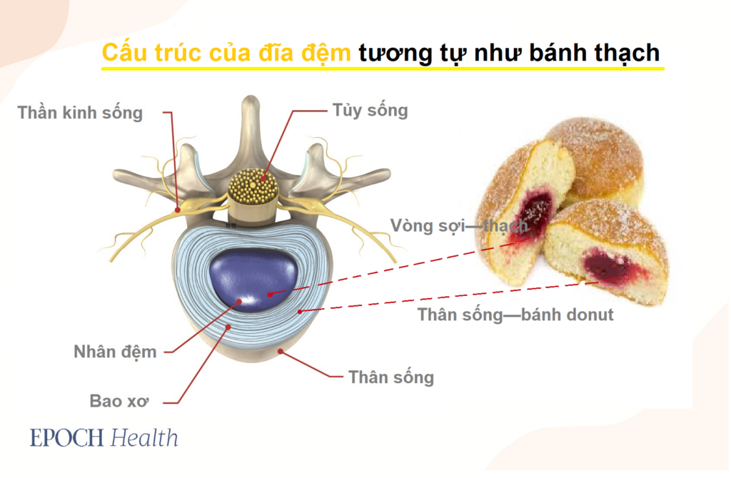 Đau thắt lưng: Nguyên nhân, điều trị và dự phòng