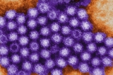 Hình ảnh các hạt norovirus dưới kính hiển vi điện tử trong một tệp ảnh không ghi ngày tháng. (Ảnh: Charles D. Humphrey/Trung tâm Kiểm soát và Phòng ngừa Dịch bệnh Hoa Kỳ)