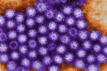 Hình ảnh các hạt norovirus dưới kính hiển vi điện tử trong một tệp ảnh không ghi ngày tháng. (Ảnh: Charles D. Humphrey/Trung tâm Kiểm soát và Phòng ngừa Dịch bệnh Hoa Kỳ)