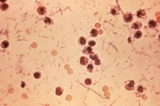 Máy chụp ảnh hiển vi này cho thấy vi khuẩn Shigella. (Ảnh: Sở Y tế Hawaii)