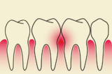 Bệnh răng miệng là một vấn đề nan giải từ xưa đến nay. Trung y điều trị bệnh nha chu và chăm sóc răng như thế nào? (Ảnh: Shutterstock)
