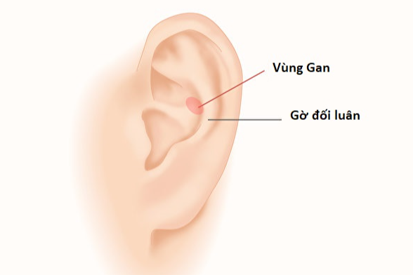 Bốn dấu hiệu của cơ thể có thể là ung thư gan