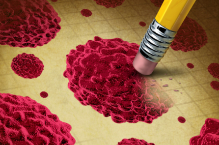 Liệu pháp kiềm hóa tế bào có thể giúp điều trị ung thư