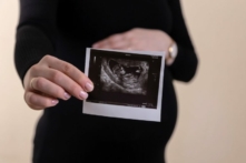 Một phụ nữ mang thai đang cầm hình ảnh siêu âm. (Ảnh: Volodymyr Hryshchenko/Unsplash)