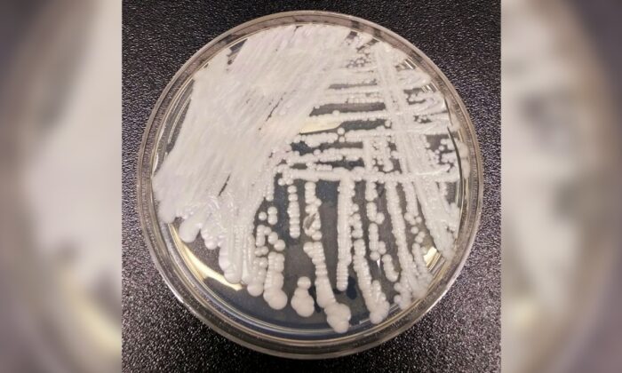 Bức ảnh không đề ngày tháng này do Trung tâm Kiểm soát và Phòng ngừa Dịch bệnh (CDC) cung cấp cho thấy một chủng nấm Candida auris được nuôi cấy trong đĩa petri tại phòng thí nghiệm của CDC. (Ảnh: The Canadian Press/Shawn Lockhart-CDC qua AP)