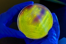 Hình ảnh môi trường nuôi cấy vi khuẩn trên đĩa petri. (Ảnh: CDC/Melissa Dankel)