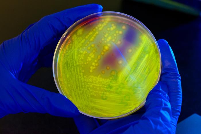 Hình ảnh môi trường nuôi cấy vi khuẩn trên đĩa petri. (Ảnh: CDC/Melissa Dankel)
