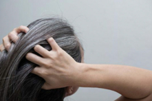 Trung y cho rằng tóc là hiện thân của vấn đề về huyết.  (Ảnh: Shutterstock)