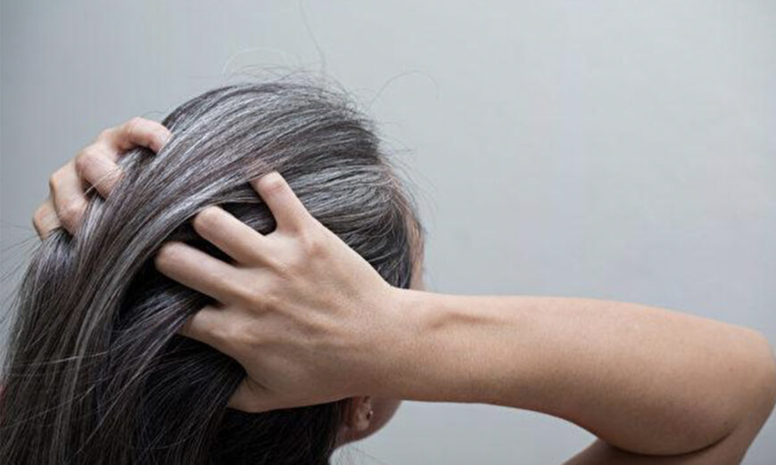 3 nguyên nhân gây ra tóc bạc và 3 cách đảo ngược tình trạng bạc tóc