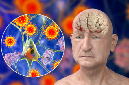 COVID-19 làm tăng tốc độ lão hóa não như thế nào và cách bảo vệ bản thân