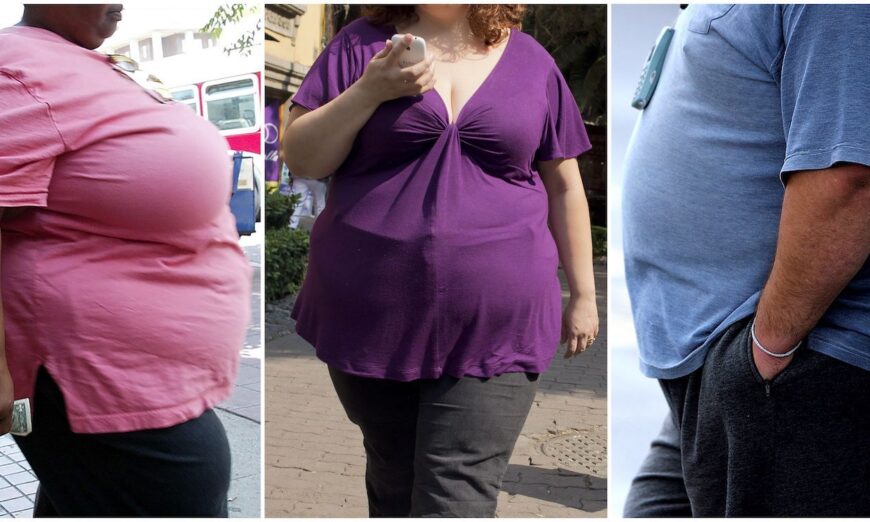 Báo cáo: ‘Mối liên quan chặt chẽ’ giữa béo phì và bệnh tự miễn